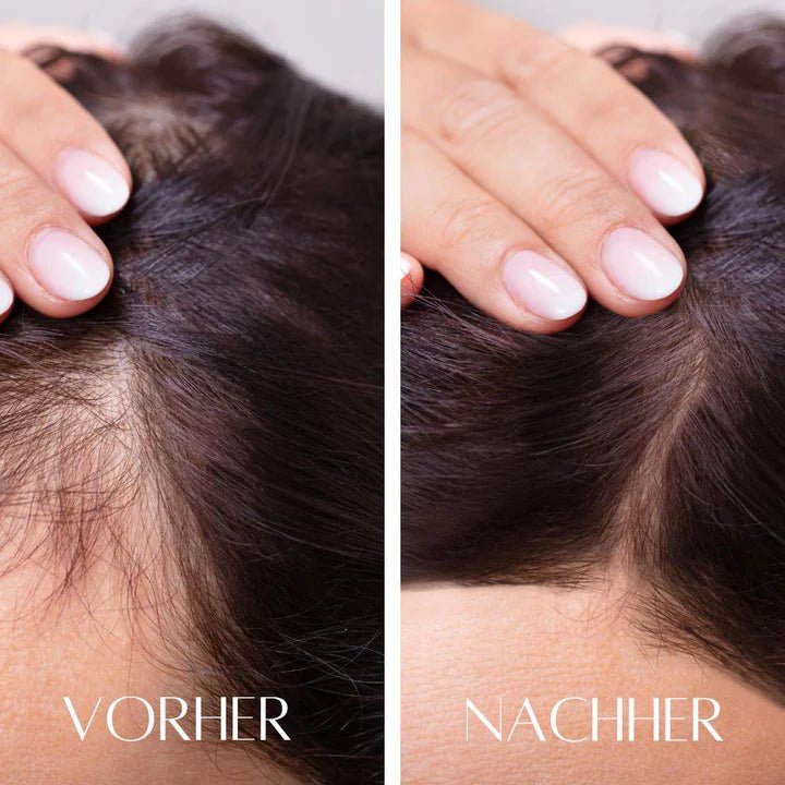 Hanna 3in1 Kopfhaut Massagebürste – Fördert Haarwachstum, entspannt & bringt deine Kopfhaut ins Gleichgewicht