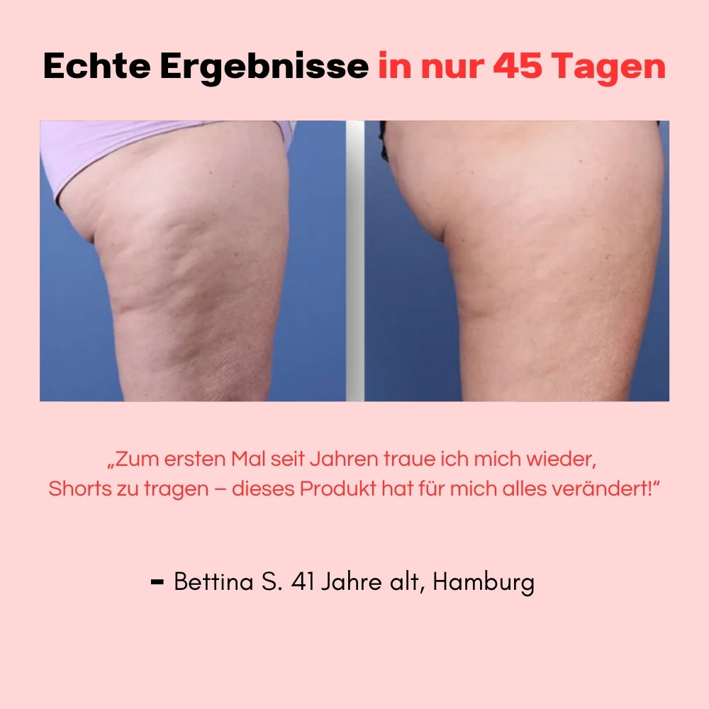 Hanna Sculpt – 3in1 Straffungs-Massager