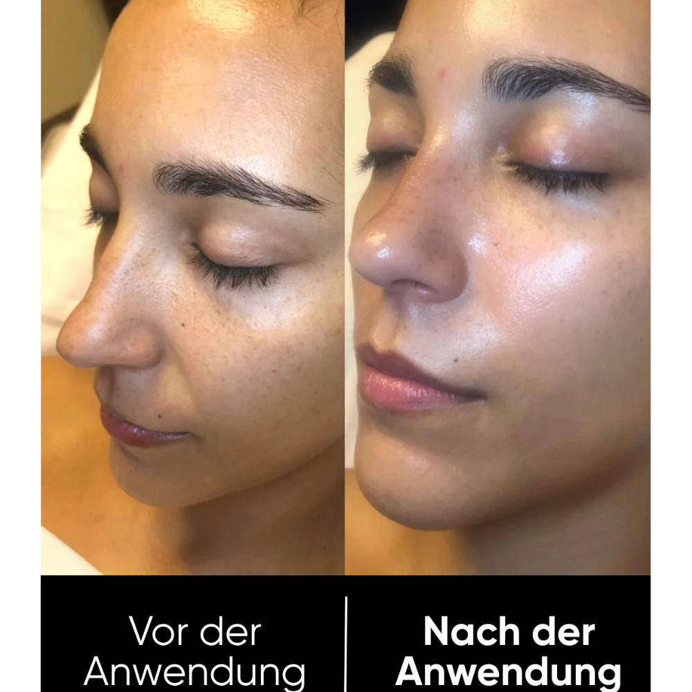 Hanna Reis Peel Shot Duo - Feinere Poren & glattere Haut in nur 3 Minuten