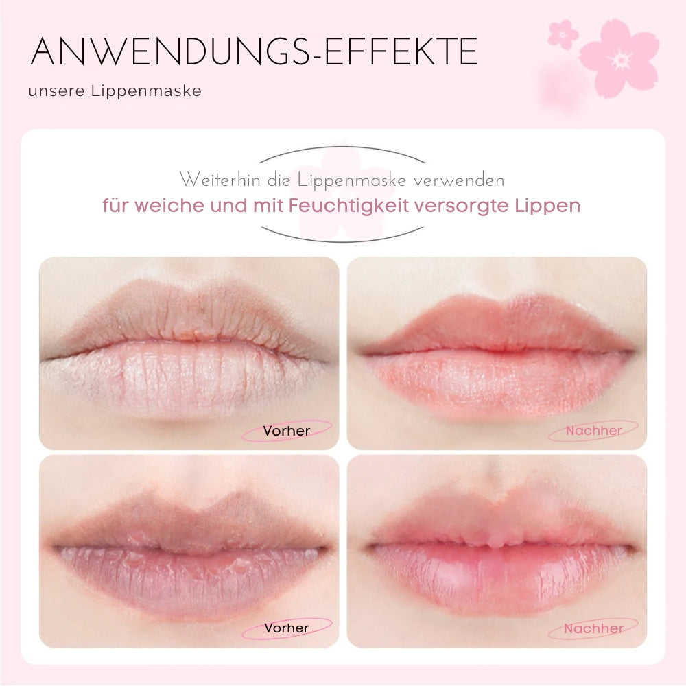 10x Hanna - Lippenmaske
