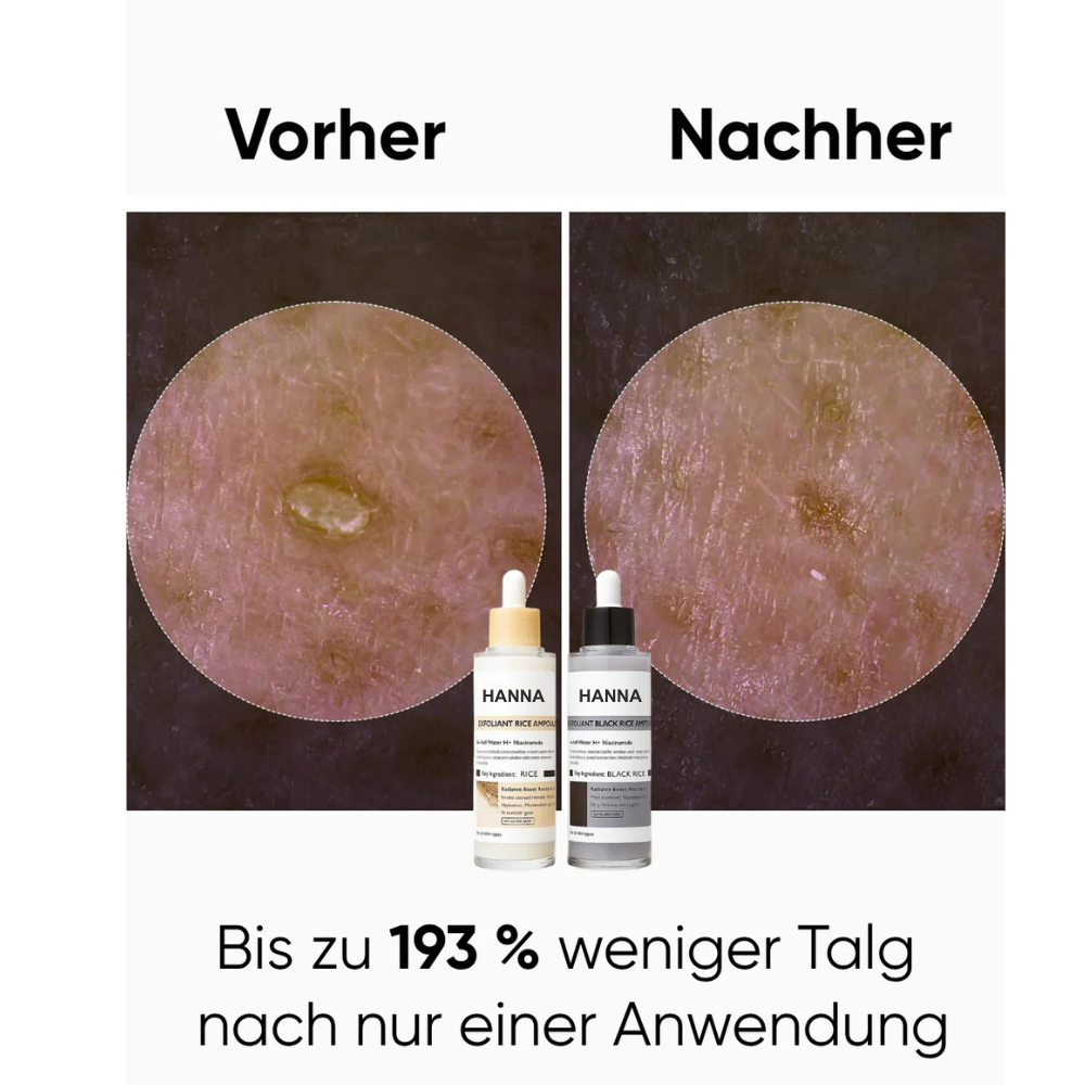 Hanna Reis Peel Shot Duo - Feinere Poren & glattere Haut in nur 3 Minuten