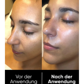 Hanna Reis Peel Shot Duo - Feinere Poren & glattere Haut in nur 3 Minuten