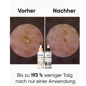 Hanna Reis Peel Shot Duo - Feinere Poren & glattere Haut in nur 3 Minuten